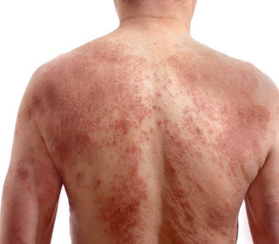 dermatology-conditions