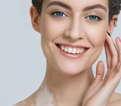 vitiligo-surgery